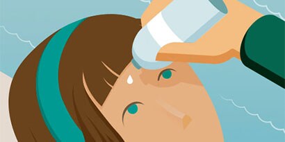 UM REGALO PARA A VISTA! SUGESTÕES PARA LESÕES OCULARES
